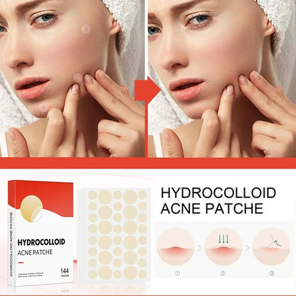 Pimple Acne Patches