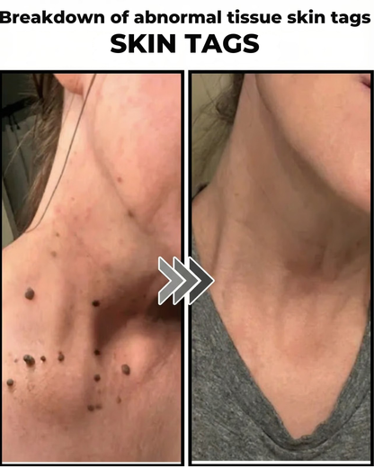 Skin Care Patches