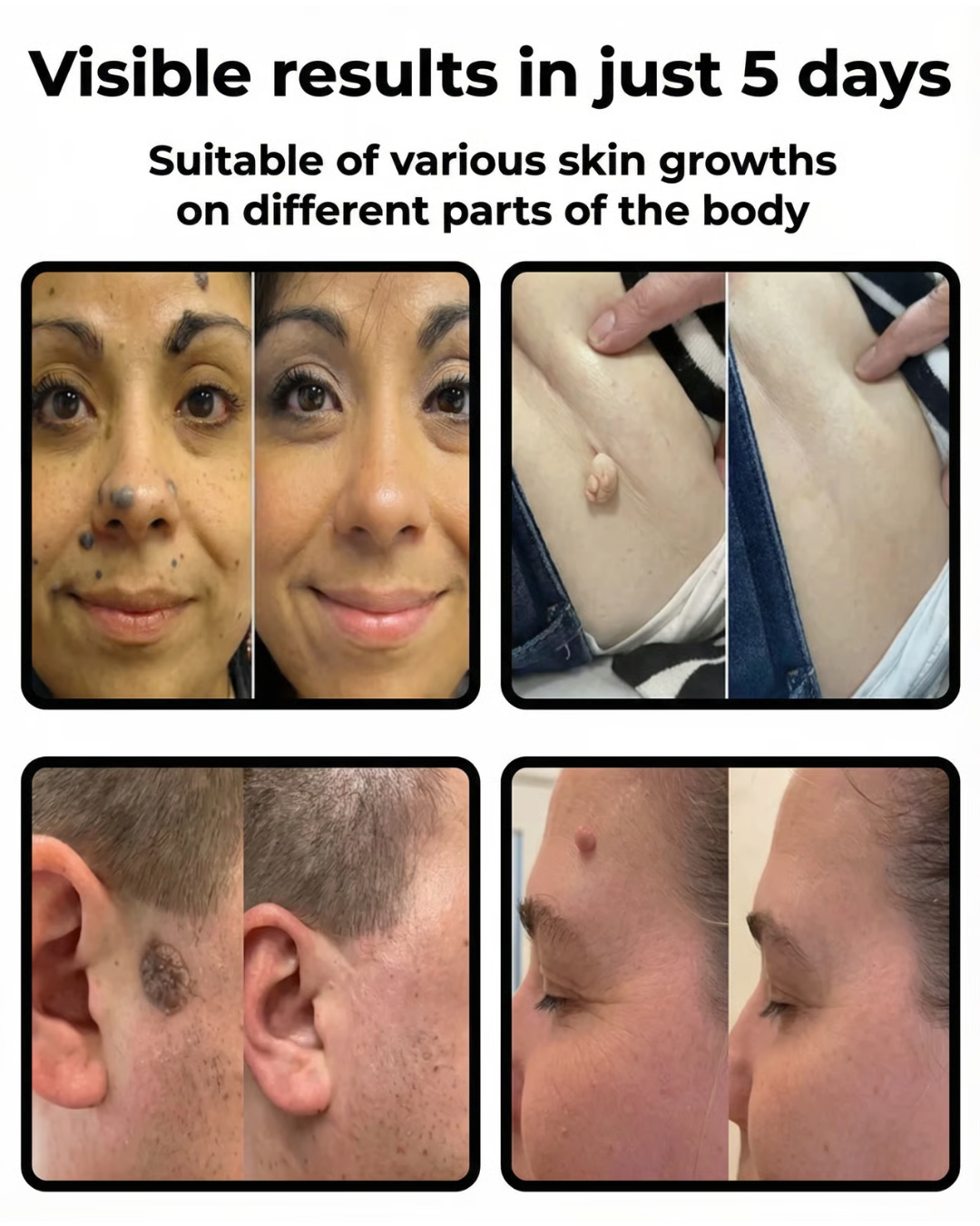 Skin Care Patches