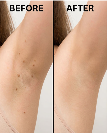 Skin Care Patches