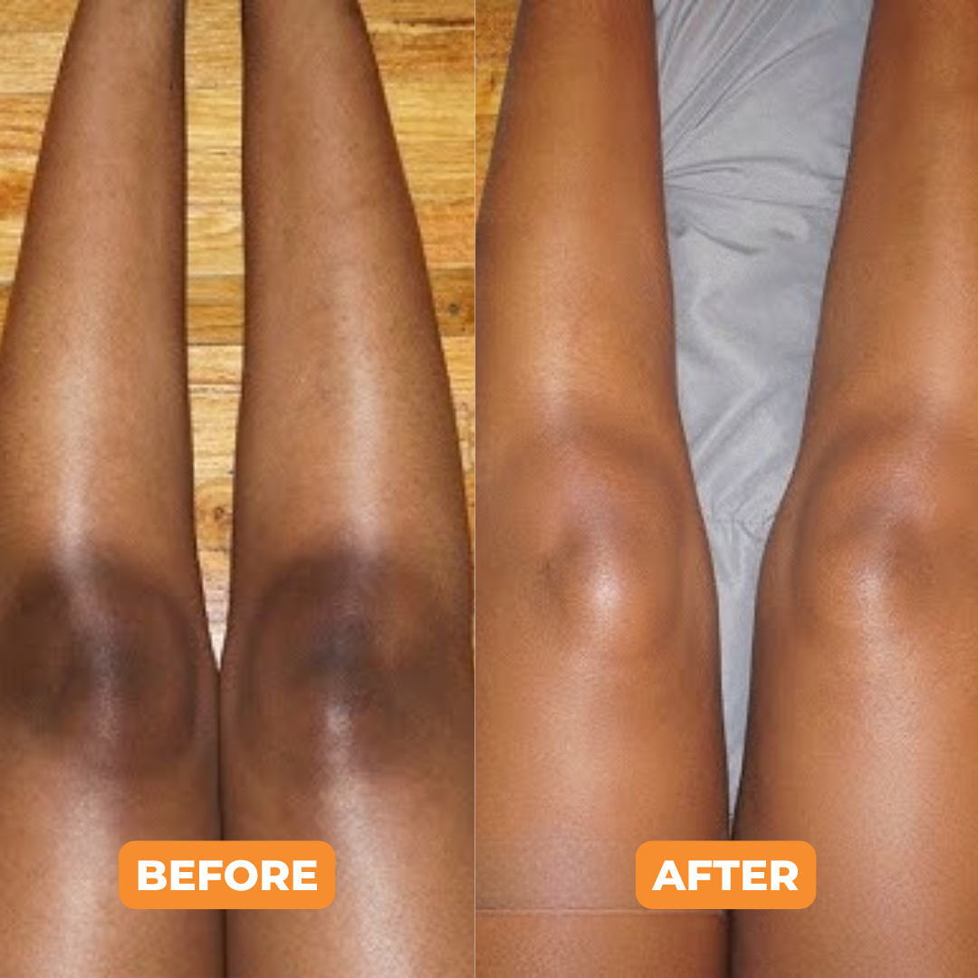 Exfoliating Whitening Gel