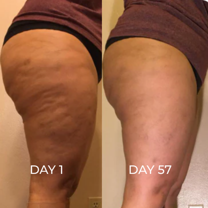 TonePulse-Cellulite Massager