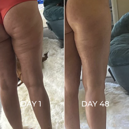 TonePulse-Cellulite Massager