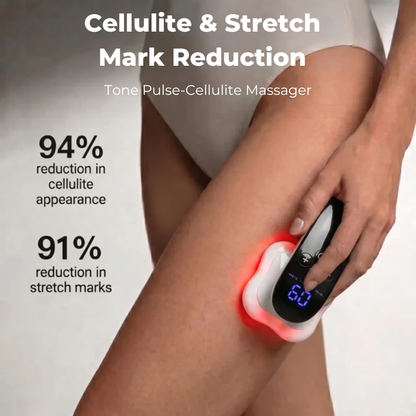 TonePulse-Cellulite Massager