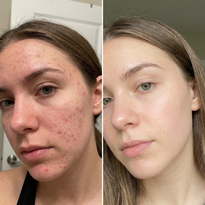 Skin Care Patches