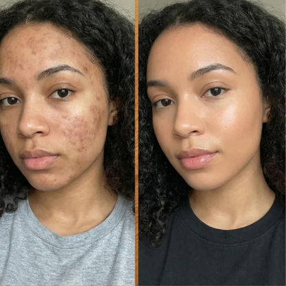 New Look Facial Mask