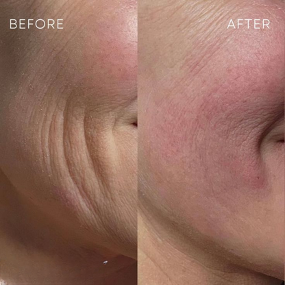 New Look Facial Mask