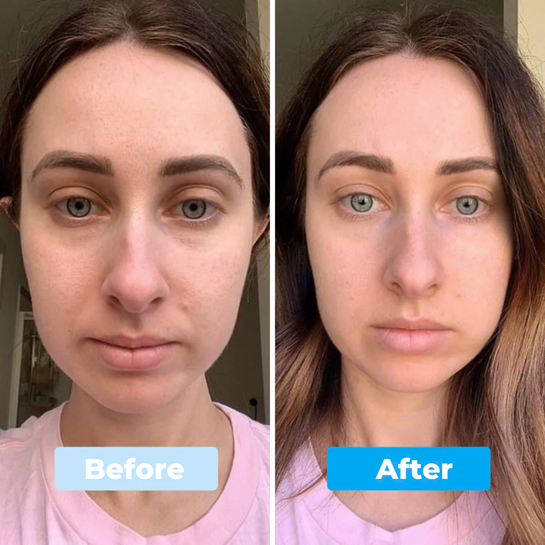 Avocado Eye Patches