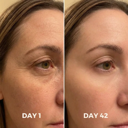 Reedle Shot Eye Lifting Cream
