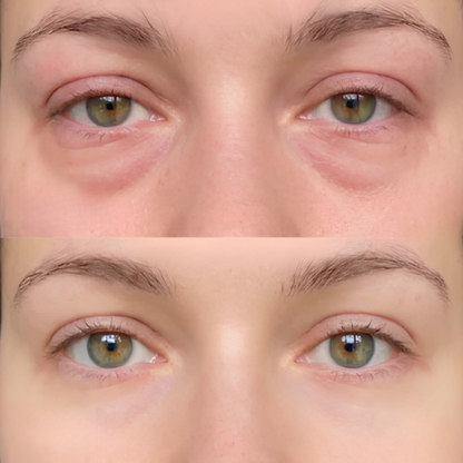 Reedle Shot Eye Lifting Cream