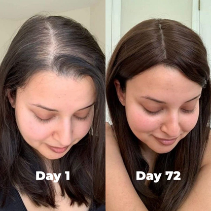 Postpartum Hair Growth Gummies