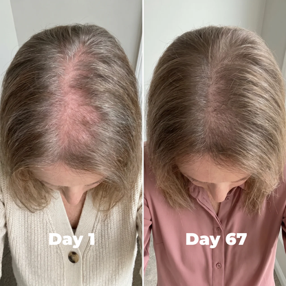 Postpartum Hair Growth Gummies