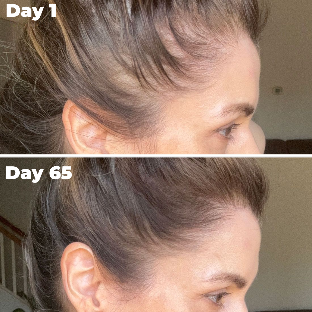 Postpartum Hair Growth Gummies