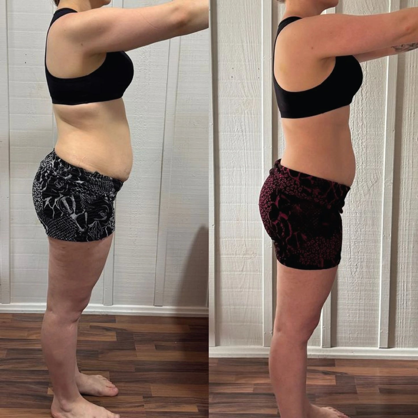 SkinSculpt Pro™