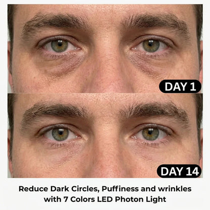 Eye Therapy Mask