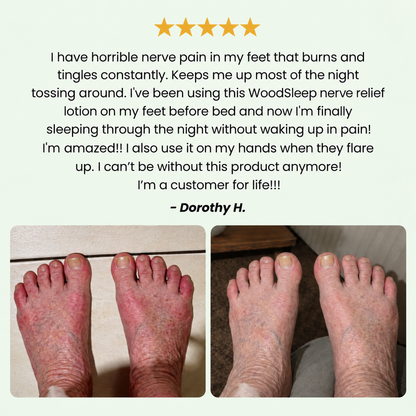 WoodSleep- Nerve Relief Lotion