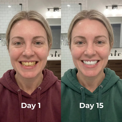 Hismile Whitening Serum