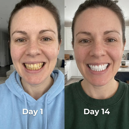Hismile Whitening Serum