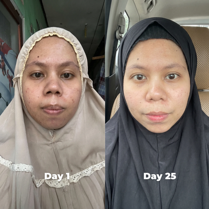 Age Booster Beauty Device