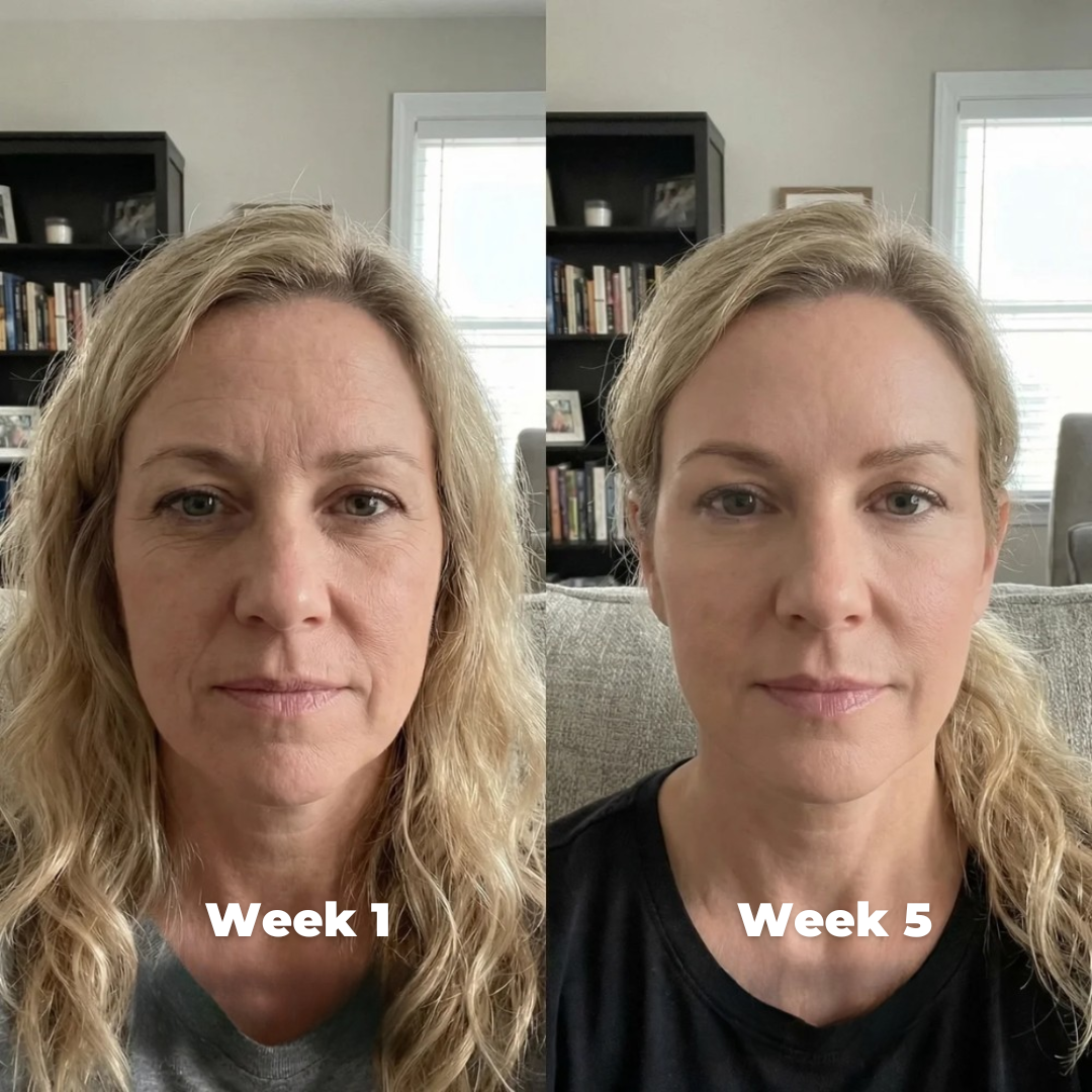 Age Booster Beauty Device