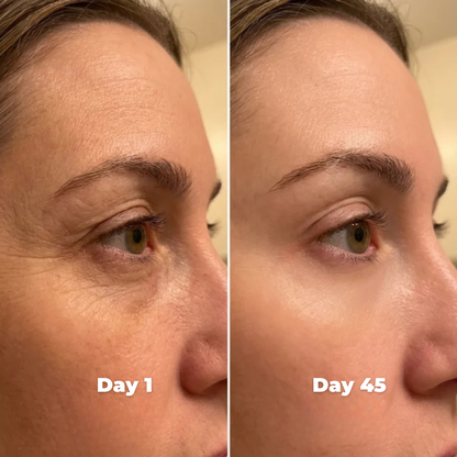 Age Booster Beauty Device