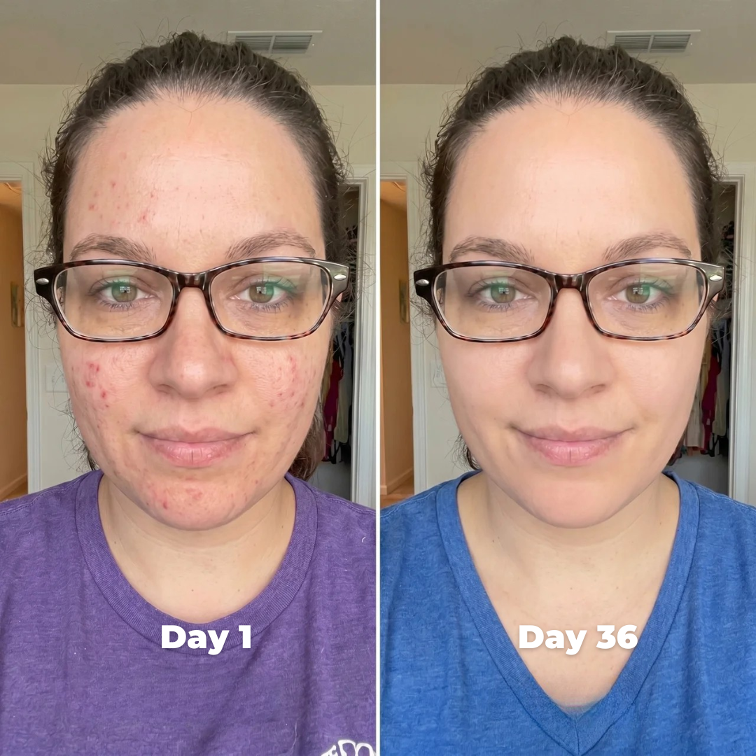Age Booster Beauty Device